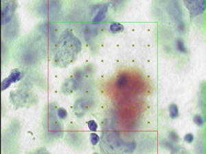 A disector probe simulated in a microscope for computerized stereology can be used to analyze tissue samples in an unbiased manner where a square will be placed over a region of interest, and systematically counted.
