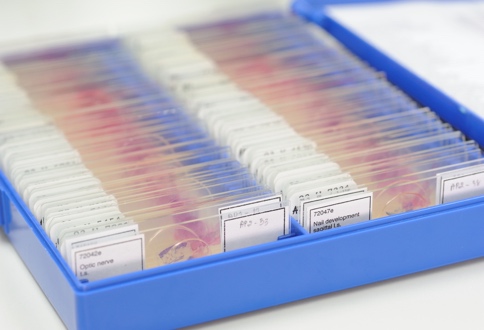 microscope slides in container