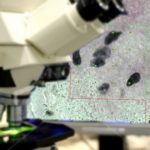 4 Reasons your Microscope is Excellent for Computerized Stereology