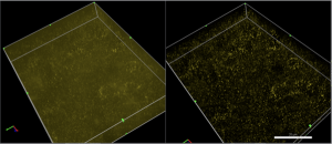 Difference in widefield fluorescence microscopy samples. Deconvolution filters out much of the noise producing distinct subcellular objects. 