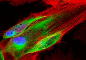 fluorescence microscopy is prime for allowing cells to be visualized.